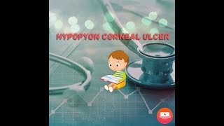 Corneal disease 1Hypopyon Corneal Ulcer [upl. by Allegra]