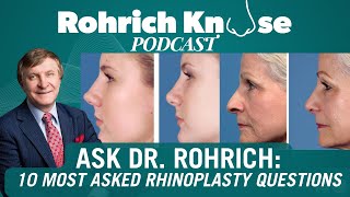 Ask Dr Rohrich  10 Commonly Asked Rhinoplasty questions [upl. by Enylekcaj16]