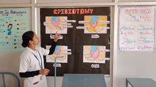 explanation about episiotomy procedure🧑‍⚕️ shortvideo exploremore exploremore episiotomy nurse [upl. by Marlie]