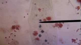 Paramecium Caudatum Feeding at 100x and 400x [upl. by Mallon309]