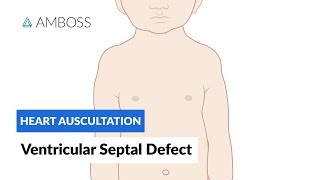 Ventricular Septal Defect VSD  Heart Auscultation  Episode 11 [upl. by Eustis]