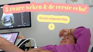 6 7 amp 8 WEKEN ZWANGER 🤰🏼👶🏼❤️  KOTSMISSELIJK DOODMOE amp EERSTE ECHO  EERSTE TRIMESTERVLOG 3 [upl. by Townie]