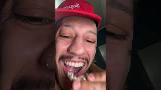 Grillz no dente [upl. by Bael]