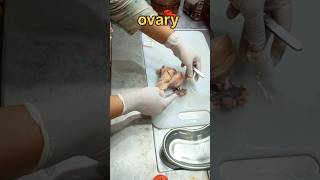 Ovary tissue sample ovary கருமுட்டை pathology pcodpcos pcos ovariancyst ovariandisease [upl. by Prebo705]