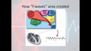 Basic Electrophysiology part 7  Atrial Rhythms part 3 Atrial Fibrillation and Atrial Flutter [upl. by Adiahs350]