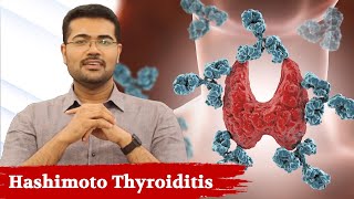 Watch This If You Have Thyroid ProblemHashimoto Thyroiditis  Dr Manoj Johnson [upl. by Llennor]