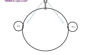 Weber vs Rinne Test amp Conductive vs Sensorineural Hearing Loss [upl. by Noryahs258]