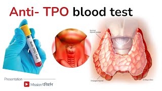 AntiTPO antibodies  treatment for high antiTPO [upl. by Nyleve]