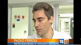 Paolo Ferroli neurochirurgo dell istituto Besta di Milano [upl. by Aihsekan]