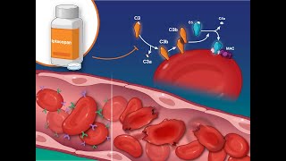 Iptacopan for Paroxysmal Nocturnal Hemoglobinuria  NEJM [upl. by Haldeman]