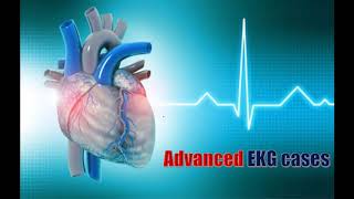 شرح تخطيط القلب ECG  الحلقة التاسعة  Advanced EKG cases Part 1 QT Interval and Tachyarrhythmia [upl. by Manouch783]