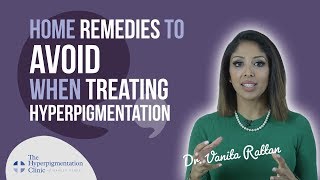 How to Treat Hyperpigmentation  Home Remedies  DO THEY WORK [upl. by Lemej313]