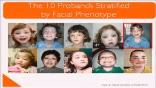 ASHG 2010 Mtg quotDiscovery of a Gene for Kabuki Syndrome by Exome Sequencingquot Mark Hannibal [upl. by Webster946]