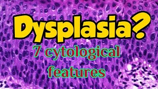 7cytological features of Dysplasia Medschool Microvlog 8 [upl. by Lebar]