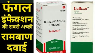 luliconazole lotion for fungal infection  lulican lotion uses side effect [upl. by Nossah]