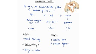 CONTRACTED PELVIS NOTES  OBSTETRICS  OBGY  ONE PAGE NOTES  4TH PROFF  MBBS [upl. by Underwood650]