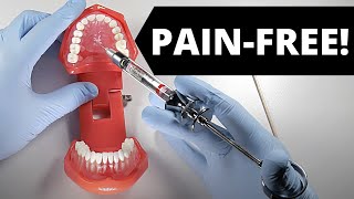 Deliver A Painless Palatal Injection  OnlineExodontiacom [upl. by Archambault]