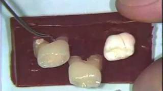 Dental Anatomy Primary Dentition [upl. by Guy]