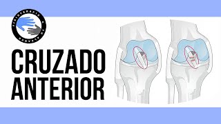 ¿Ligamento cruzado anterior roto 2 test para evaluarlo [upl. by Row]