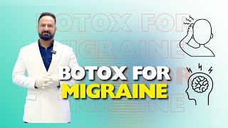 Botox Marking Points for Migraine Relief Expert Tips by Dr Ajay Rana [upl. by Konyn]