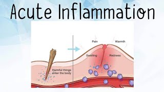 Inflammation Pathology Acute Inflammation [upl. by Ainek209]