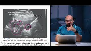 Ep 94 Gastroschisis8 case study CS amp premature deliveryDr Khaled Salah gastroschisis premature [upl. by Oiluarb]