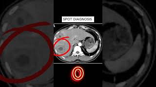 X ray quiz 37 nursing nursingstudent doctor USMLE MBBS hospital anatomy ctscan radiology [upl. by Htebsle]