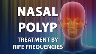 Nasal Polyp  RIFE Frequencies Treatment  Energy amp Quantum Medicine with Bioresonance [upl. by Mountfort]