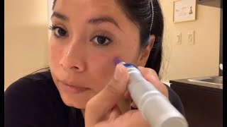 Nano Needling mini facial amp my skin type [upl. by Grizelda241]