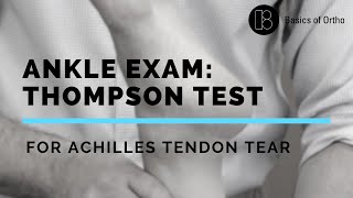 Ankle Exam Thompson Test for Achilles Tendon Rupture [upl. by Eatnoid]