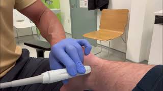 Flexor Hallucis Longus tendon injection by ultrasound guidance [upl. by Ttik]