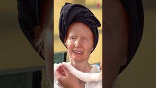 From Albinism to First Date A Remarkable 40YearOld Womans Journey shorts [upl. by Wrench]