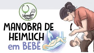 Manobra de Heimlich  Desobstrução de vias aéreas em bebê [upl. by Curley]