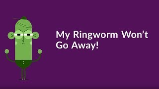 My Ringworm Won’t Go Away Quickest Way to Get Rid of Ringworm [upl. by Naples]