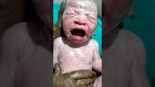 Essential care of new born baby shortsvideo cutebaby newbornarrival newbornbaby [upl. by Gerc82]