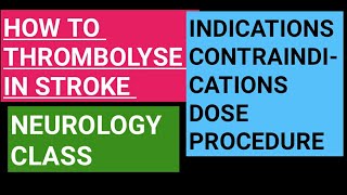 Thrombolysis in acute stroke  indications contraindications dose and procedure [upl. by Hachman]