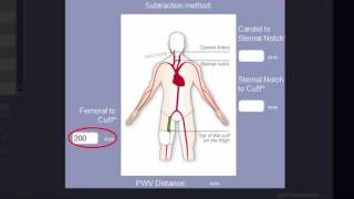 Training Video Setting up SphygmoCor XCEL Version 13 [upl. by Boyce]