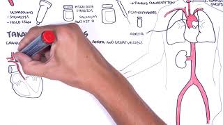 Giant cell Arteritis and Takayasu arteritis Large Vessel Vasculitis  signs pathophysiology [upl. by Wye]