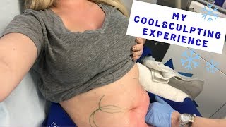 MY COOLSCULPTING EXPERIENCE and GIVEAWAY  Before amp Afters  KelseyRae Mua [upl. by Tomlin]