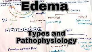 Pulmonary Edema Fluid In the Lungs Symptoms amp causes [upl. by Ylrebmic402]