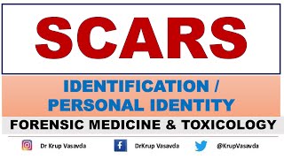 Scars  Identification  Dr Krup Vasavda [upl. by Ally734]