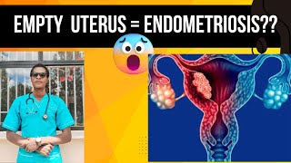 CAN EMPTY UTERUS CAUSE ENDOMETRIOSIS STAYING FOR LONG WITHOUT GIVING BIRTH CAN CAUSE ENDOMETRIOSIS [upl. by Hurleigh]