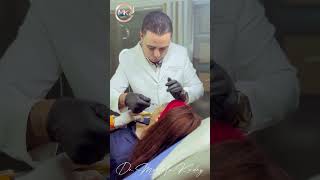 Injection Techniques Dermal Filler Chin amp Cheek with dr mostafa kadry filler dermatologist [upl. by Goldwin89]