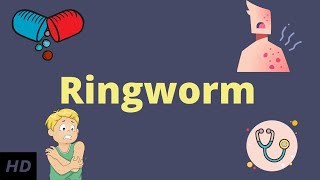 Ringworm Causes Signs and Symptoms Diagnosis and Treatment [upl. by Bennir778]