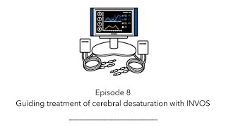 INVOS™ oximetry in the NICU Byte 8 Guiding treatment of cerebral desaturation with INVOS™ oximetry [upl. by Ramedlaw]