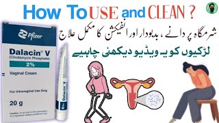 Dalacin v vaginal cream  how to use Clindamycin Phosphate vaginal cream [upl. by Helas]