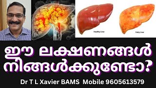 കരൾ രോഗങ്ങൾ  Dr Xavier Reveals Ayurvedic SECRETS for Liver Health [upl. by Mou155]