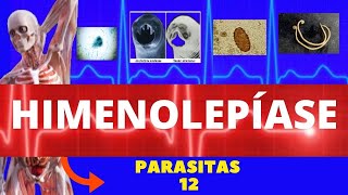 HIMENOLEPÍASE  HYMENOLEPIS NANA E HYMENOLEPIS DIMINUTA TÊNIA ANÃ  PARASITOLOGIA INFECTOLOGIA [upl. by Calysta]