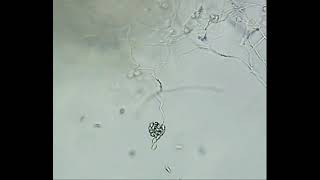 Release of Zoospores by Pythium sp [upl. by Resay892]