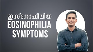 ഇസ്നോഫീലിയ I Eosinophilia symptoms I അലർജി ഉള്ളവർ മാത്രം കാണുക Part 02 [upl. by Ansel]